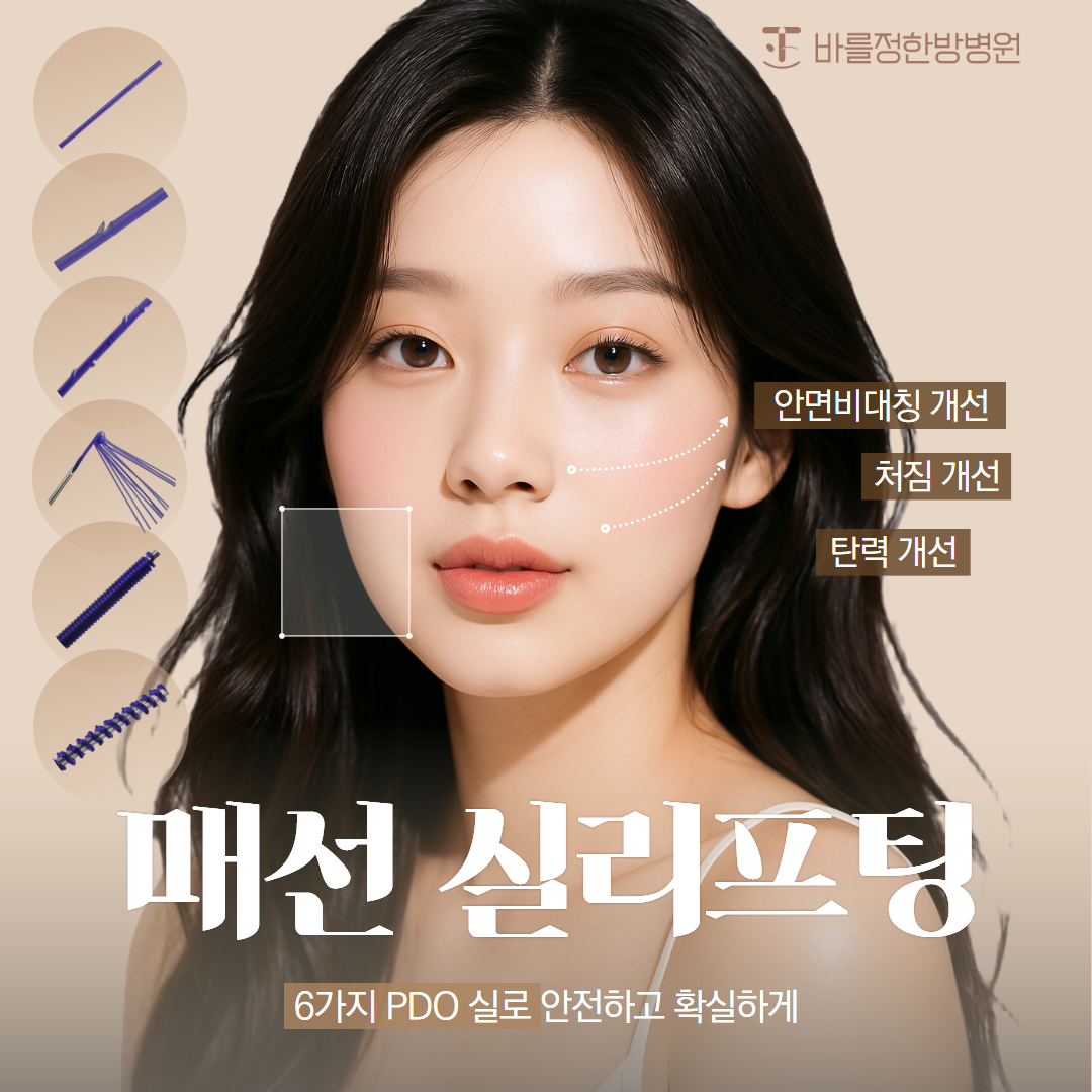 실리프팅